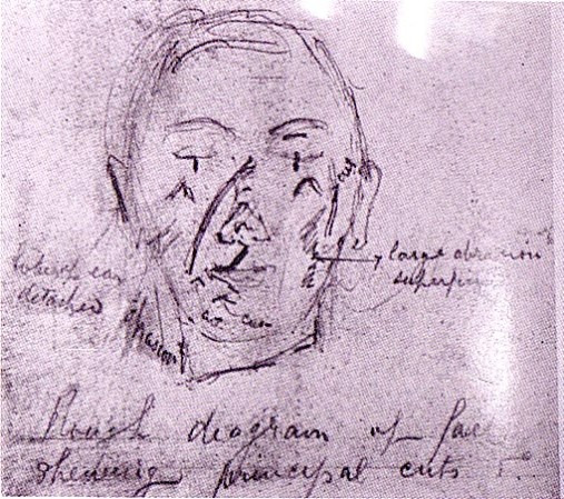 El rostro de Eddowes, una prostituta ocasional que tenía 46 años.