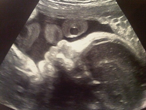 Su primera foto.
