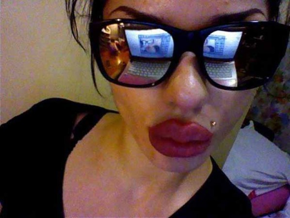 Se convenció a sí misma de que sus labios la hacían fea por lo que optó por aumentarlos desmesuradamente al estilo de Jessica Rabbit.