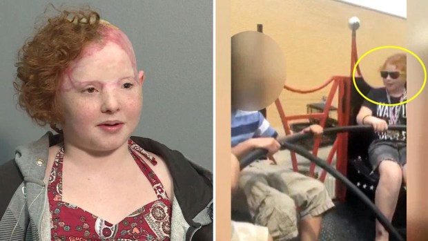 Niña cae de juego en parque de diversiones — Dramático