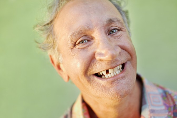 Perder los dientes…