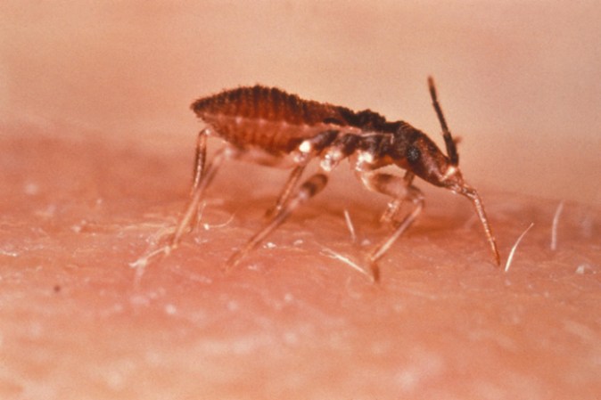 Changas es una enfermedad parasitaria causada por el protozoo Trypanosoma cruzi. Se transmite por insectos triatominos, especialmente los llamados "vinchucas" o “chinches”.