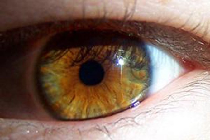 Close Up de tu ojo. A veces dan asco.