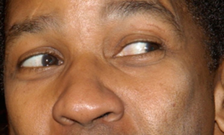 ¿De quién son estos ojos?