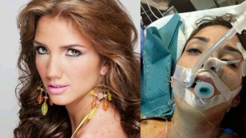 Génesis Carmona, de 21 años, era Miss Turismo Carabobo 2013. Luego de recibir un tiro en la cabeza durante una marcha que terminó en enfrentamientos en Valencia el 18 de febrero, falleció el 19 de febrero tras no superar la operación.