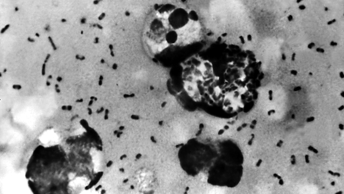 Peste negra o bubónica: síntomas, causas y la pandemia en Europa