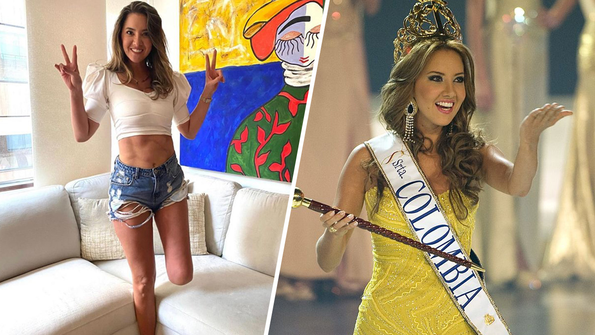 ExMiss Colombia Daniella Alvarez confiesa que su pie izquierda “no volverá  a funcionar” – Telemundo 52