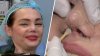 En video: así quedó Carmen Campuzano tras una nueva cirugía para arreglar su nariz