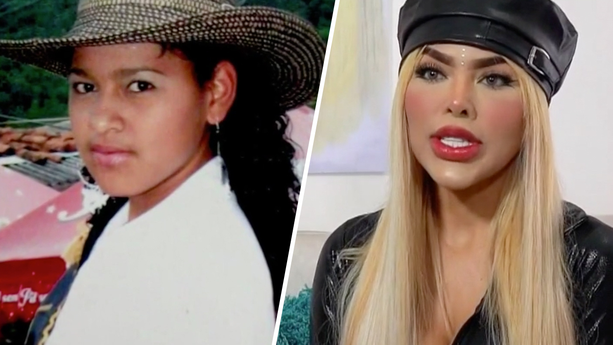 La “Barbie colombiana” cambia su color de piel para parecerse a la famosa  muñeca – Telemundo 52