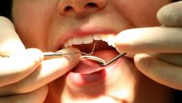 Generic stock picture of a dentist at work.   (Photo by Martin Rickett – PA Images/PA Images via Getty Images)