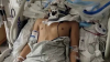 Despierta de coma adolescente tras ataque en Hemet hace 9 meses