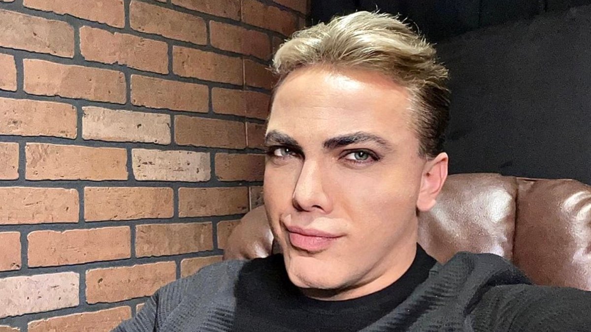 ¿Cirugía o filtro de Instagram? Cristian Castro sorprende y desata los  rumores