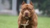 Tras amputársele una pierna, muere la mujer que fue atacada por los perros de su hijo