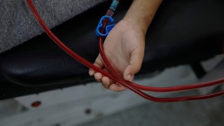 Científicos mexicanos crean tecnología que mejora la detección temprana de daño renal