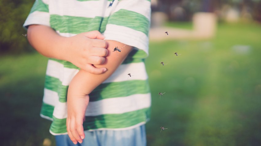 Little girl has allergies with mosquitoes bite and itching her leg.Mosquito blood breeding on kids.Repellent, Dengue virus, Yellow fever, West nile, Malaria, Diseases Spread by Mosquitoes concept.