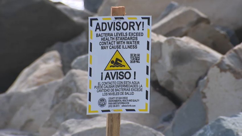 A water quality advisory sign on June 30, 2025.