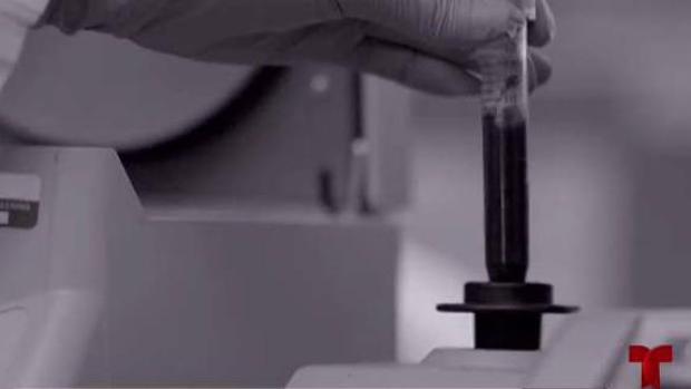 Prueba identifica pacientes en riesgo de cáncer de mama