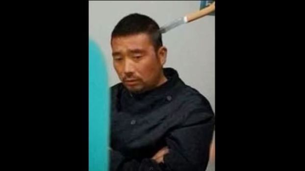 Video: Espera médico con cuchillo en la cabeza