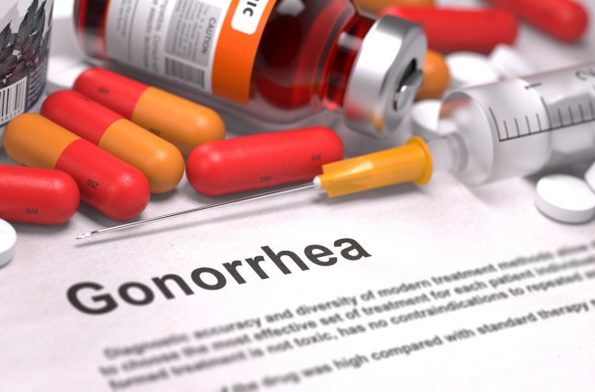 Como se contagia la gonorrea sintomas Como se contagia la gonorrea sintomas